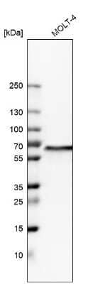 Western Blot: WDR1 Antibody [NBP2-32665]