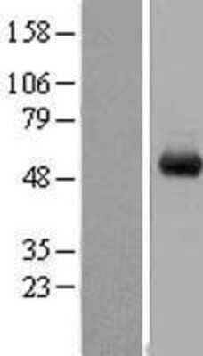 Western Blot: WDR1 Overexpression Lysate [NBL1-17791]