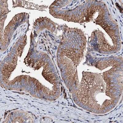 Immunohistochemistry-Paraffin: WDR11 Antibody [NBP1-89930]