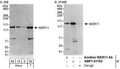 Western Blot: WDR11 Antibody [NBP1-41103]