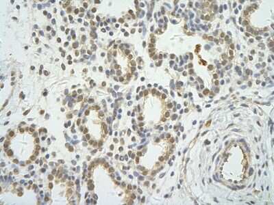 Immunohistochemistry: WDR12 Antibody [NBP1-53111]