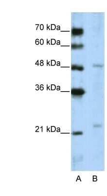 Western Blot: WDR12 Antibody [NBP1-53111]