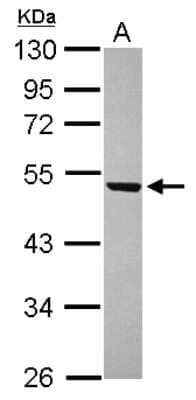 Western Blot: WDR12 Antibody [NBP2-20888]