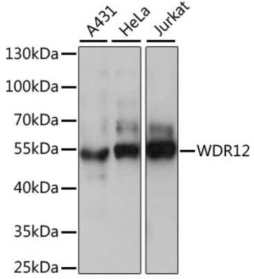 Western Blot: WDR12 AntibodyAzide and BSA Free [NBP2-94831]