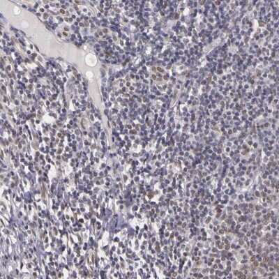 Immunohistochemistry-Paraffin: WDR13 Antibody [NBP1-85820]