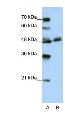 Western Blot: WDR13 Antibody [NBP1-54843]