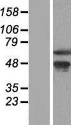 Western Blot: WDR13 Overexpression Lysate [NBP2-06903]