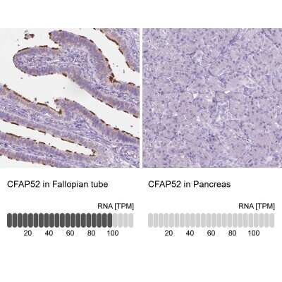 Immunohistochemistry-Paraffin: WDR16 Antibody [NBP1-81947]