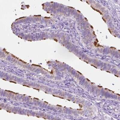 Immunohistochemistry-Paraffin: WDR16 Antibody [NBP1-81947]