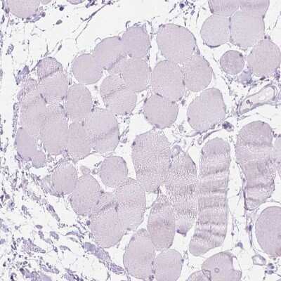 Immunohistochemistry-Paraffin: WDR16 Antibody [NBP1-81947]