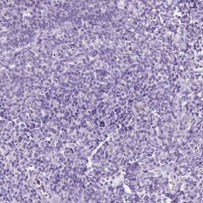 Immunohistochemistry-Paraffin: WDR16 Antibody [NBP1-81947]