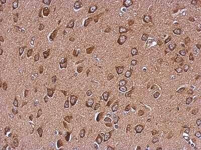 Immunohistochemistry-Paraffin: WDR16 Antibody [NBP2-20889]