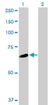 Western Blot: WDR16 Antibody [H00146845-B01P]