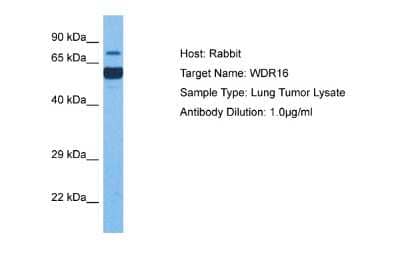 Western Blot: WDR16 Antibody [NBP2-88588]