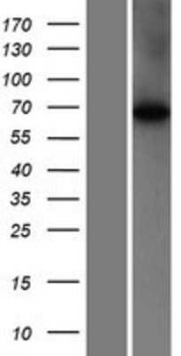 Western Blot: WDR16 Overexpression Lysate [NBP2-05511]