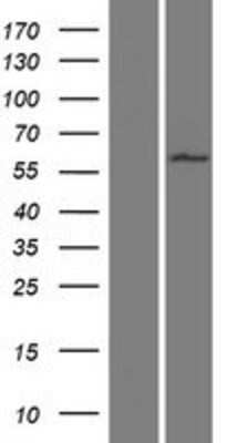 Western Blot: WDR16 Overexpression Lysate [NBP2-08406]