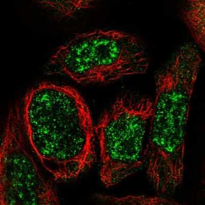 Immunocytochemistry/ Immunofluorescence: WDR17 Antibody [NBP1-90965]