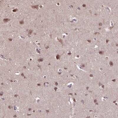 Immunohistochemistry-Paraffin: WDR17 Antibody [NBP2-68712]