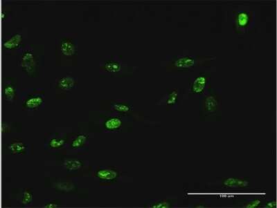 Immunocytochemistry/ Immunofluorescence: WDR18 Antibody [H00057418-B01P]