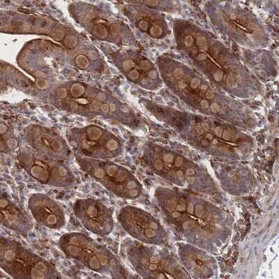 Immunohistochemistry: WDR18 Antibody [NBP2-30528]