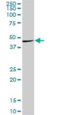 Western Blot: WDR18 Antibody [H00057418-B01P]