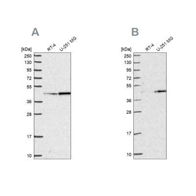 Western Blot: WDR18 Antibody [NBP2-30528]