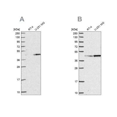 Western Blot: WDR18 Antibody [NBP2-30928]