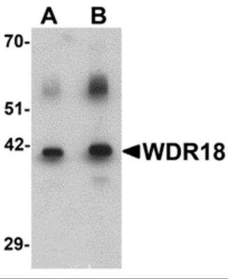 Western Blot: WDR18 AntibodyBSA Free [NBP2-81877]