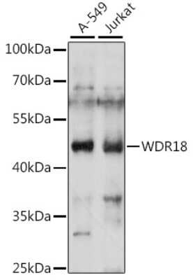 Western Blot: WDR18 AntibodyAzide and BSA Free [NBP2-93719]