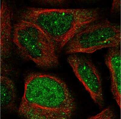 Immunocytochemistry/ Immunofluorescence: WDR19 Antibody [NBP1-84033]