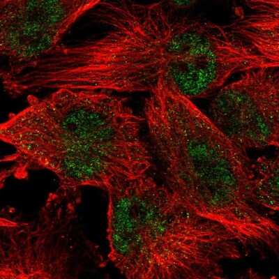 Immunocytochemistry/ Immunofluorescence: WDR19 Antibody [NBP2-58212]