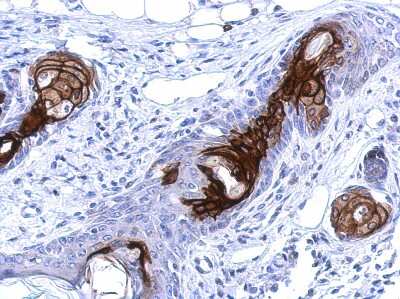 Immunohistochemistry-Paraffin: WDR19 Antibody [NBP2-20891]