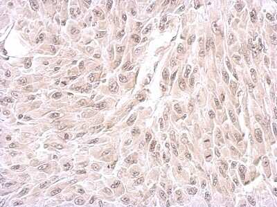 Immunohistochemistry-Paraffin: WDR19 Antibody [NBP2-20891]