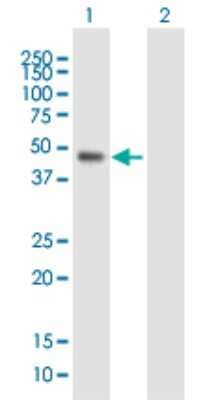 Western Blot: WDR19 Antibody [H00057728-B01P]