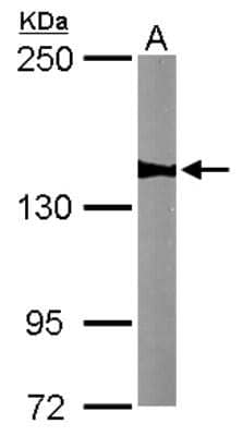 Western Blot: WDR19 Antibody [NBP2-20891]