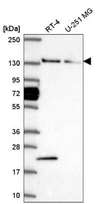 Western Blot: WDR19 Antibody [NBP2-58212]