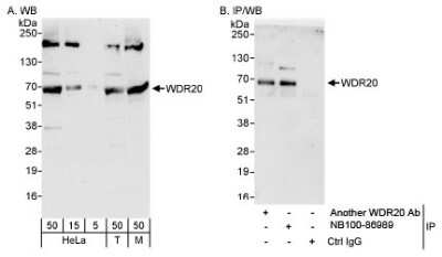 Western Blot: WDR20 Antibody [NB100-86989]