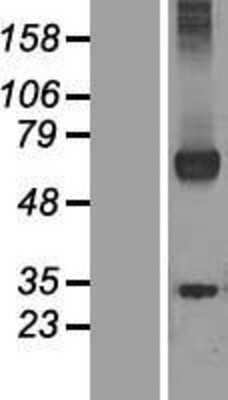 Western Blot: WDR20 Overexpression Lysate [NBL1-17795]