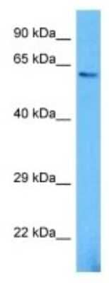 Western Blot: WDR20RT Antibody [NBP3-10156]