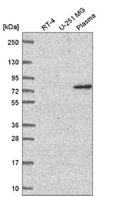 Western Blot: WDR26 Antibody [NBP2-56688]