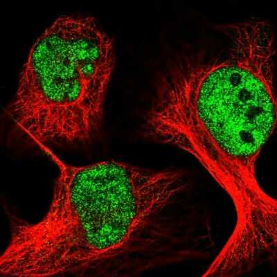 Immunocytochemistry/ Immunofluorescence: WDR27 Antibody [NBP1-81075]