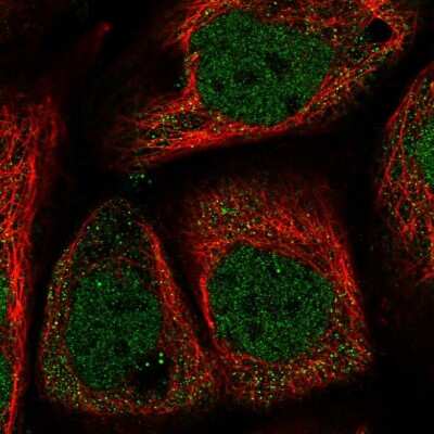 Immunocytochemistry/ Immunofluorescence: WDR27 Antibody [NBP2-38349]