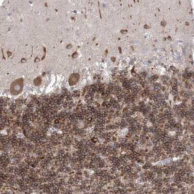 Immunohistochemistry-Paraffin: WDR27 Antibody [NBP1-81075]
