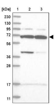 Western Blot: WDR27 Antibody [NBP1-81075]