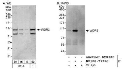 Western Blot: WDR3 Antibody [NB100-77296]