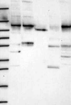 Western Blot: WDR3 Antibody [NBP3-17327]