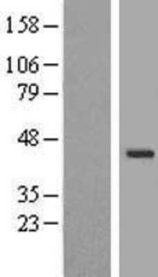 Western Blot: WDR31 Overexpression Lysate [NBL1-17800]