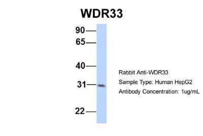 Western Blot: WDR33 Antibody [NBP1-60030]