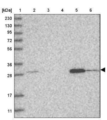 Western Blot: WDR33 Antibody [NBP1-83756]