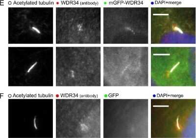 Immunocytochemistry/ Immunofluorescence: WDR34 Antibody [NBP1-88805]